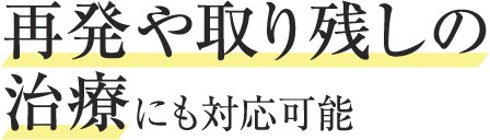 再発や取り残しの治療にも対応可能