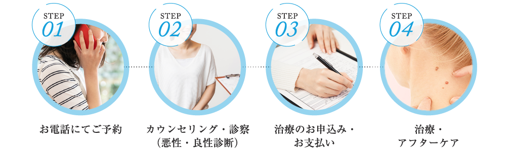 STEP01 お電話にてご予約 STEP02 カウンセリング STEP03 治療のお申込み･お支払い STEP04 治療･アフターケア